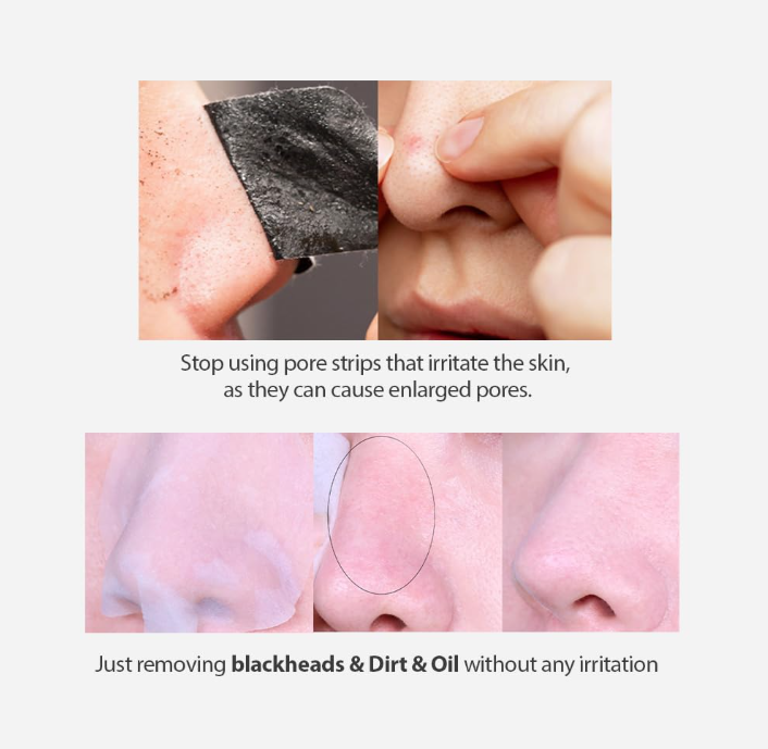 [SUNGBOON EDITOR] Blackhead Melting Clear Pad