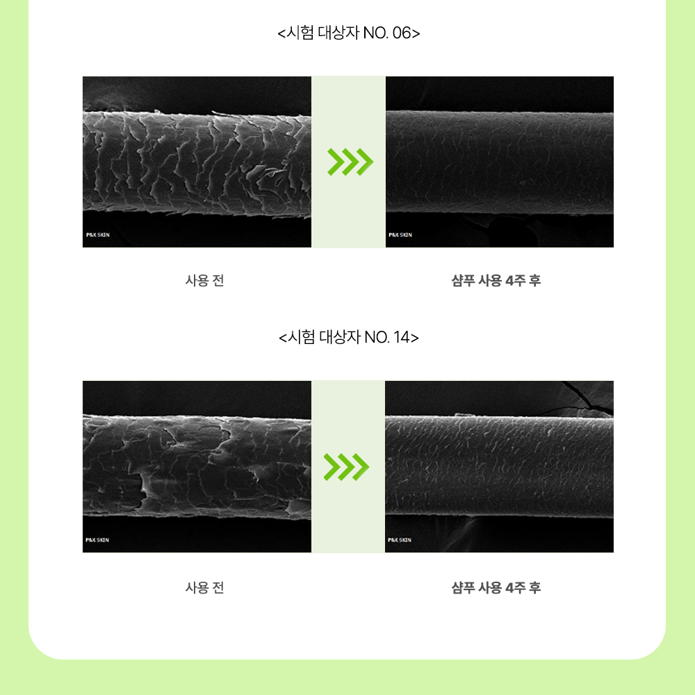  [쏘헤어] 집중 영양 데미지 케어 3종 + 사은품