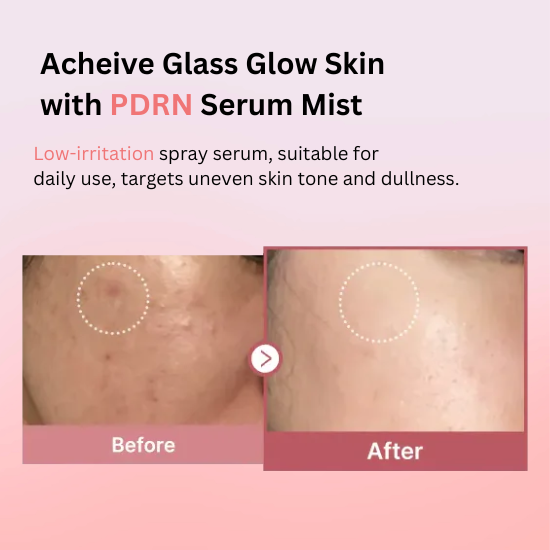glutathione review before and after pictures Be a Snow White with Total Image Whita Glo L-Glutathione 400mg Review. –  Skinfrosting main image 0