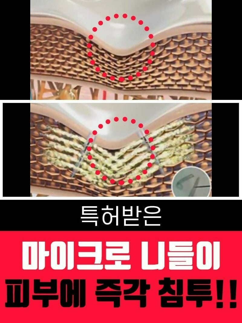 임플라힐 PO 크림 - 근육통 완화 크림 