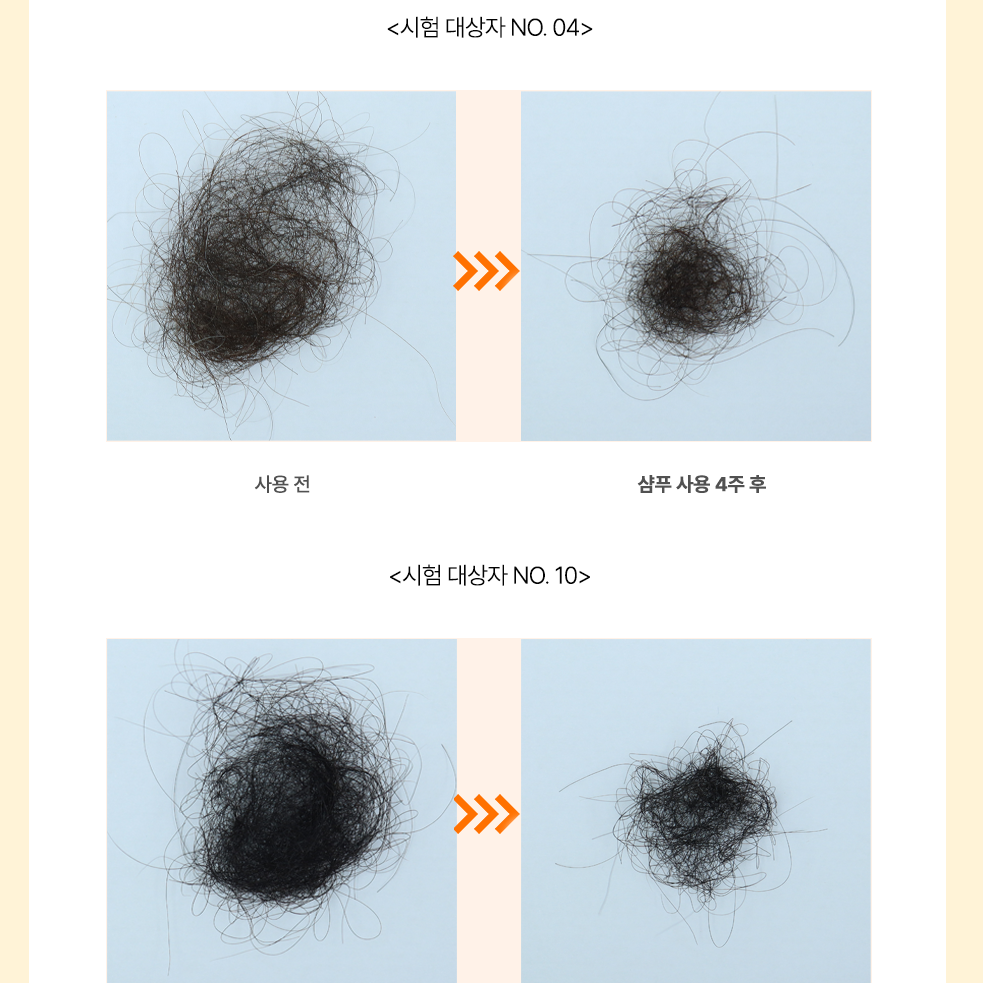  [쏘헤어] 집중 영양 데미지 케어 3종 + 사은품