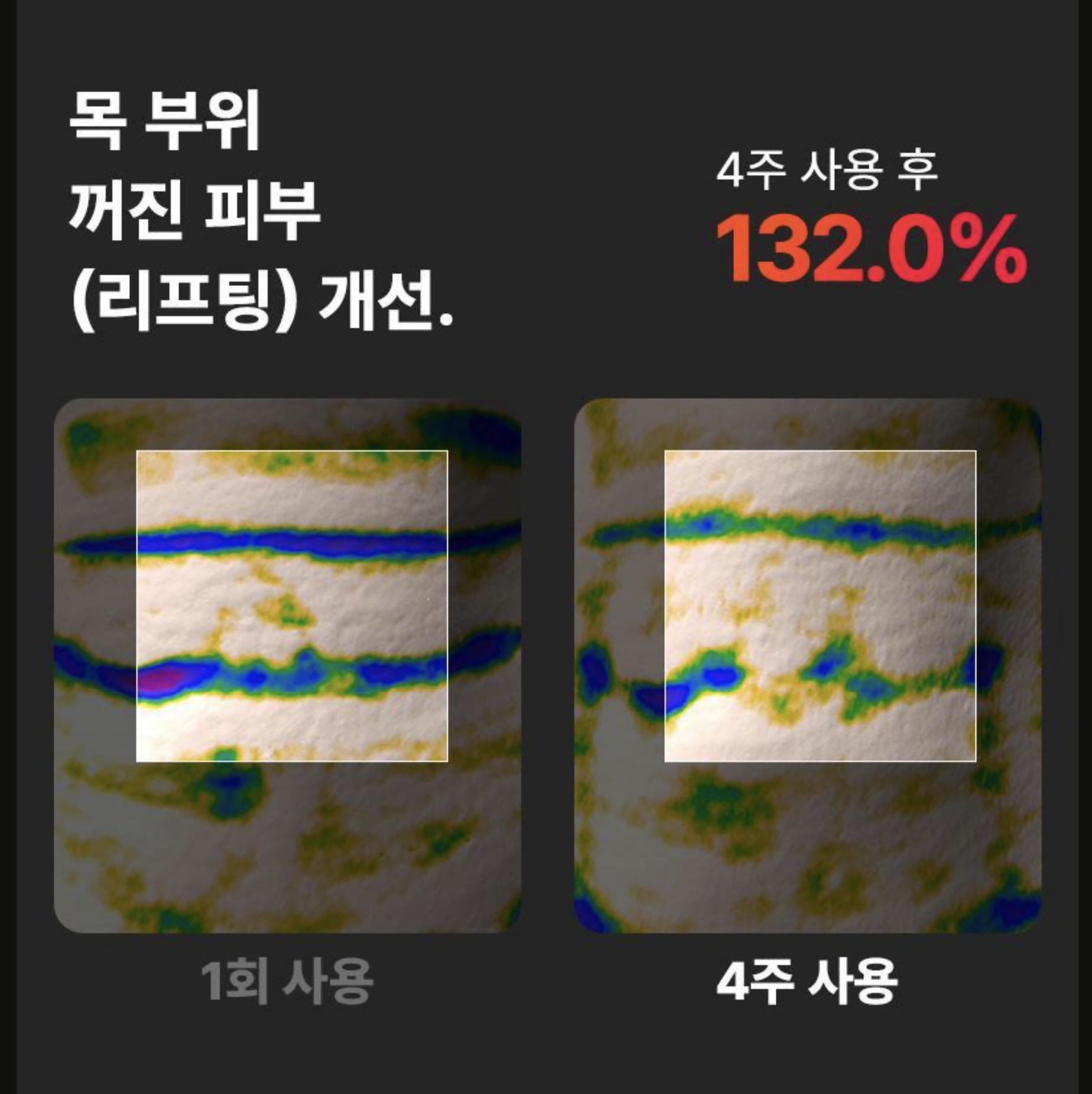BEAUND NECERA (목주름 개선 디바이스)