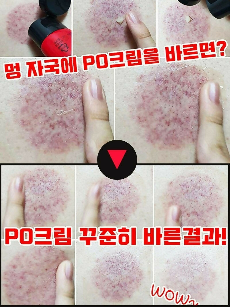 임플라힐 PO 크림 - 근육통 완화 크림 