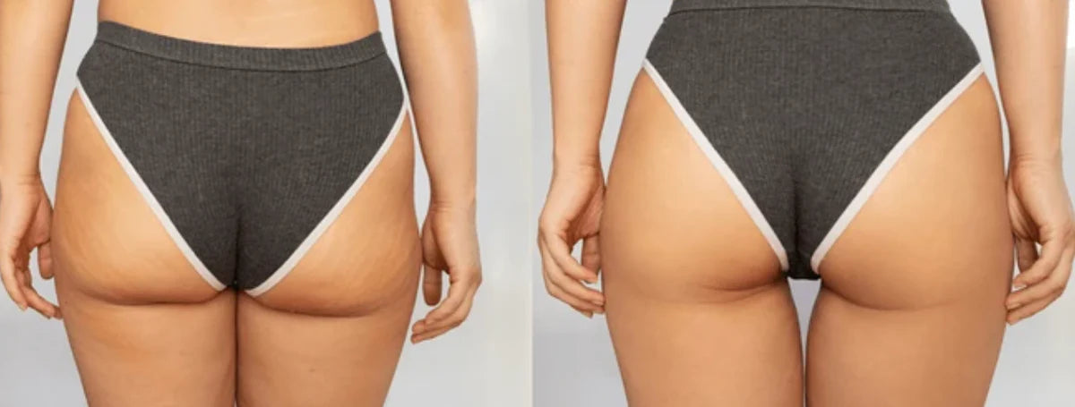 Thumbbutts Booty Cream – 힙업 & 리프팅