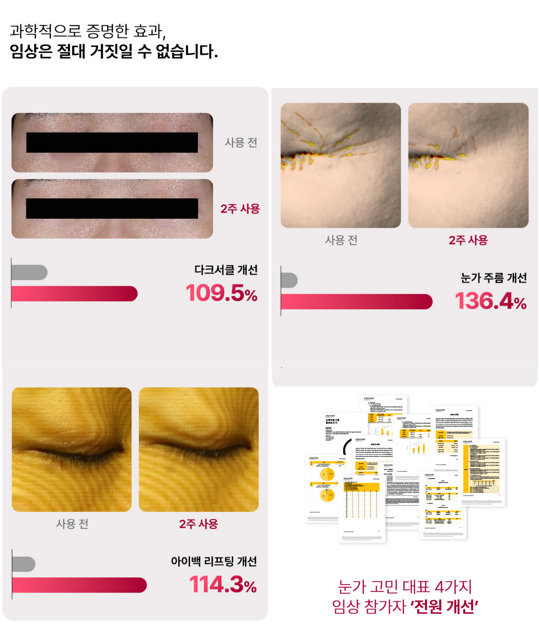 【新品未開封】beaund EYE REJUV アイリジューヴ目元ケア EMS Eye Rejuv | Korean Beauty Device | StyleKorean.com