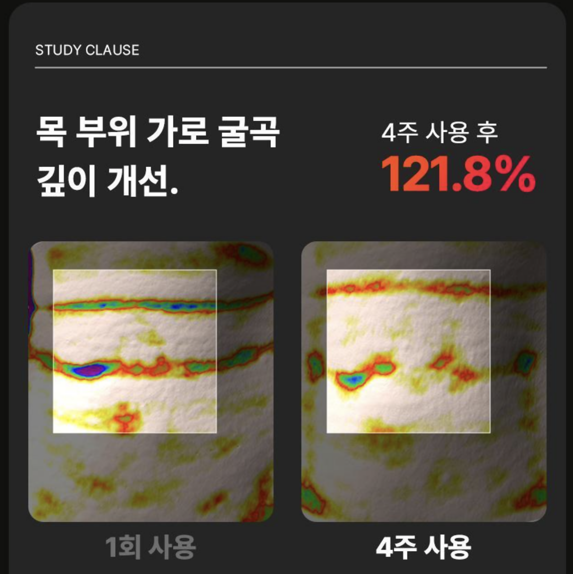 BEAUND NECERA (목주름 개선 디바이스)