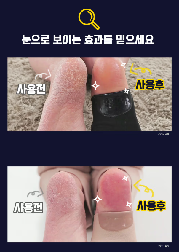 Healing Foot Care Pad