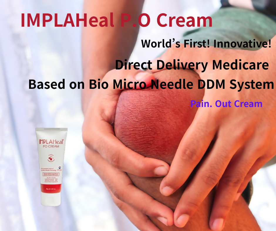 임플라힐 PO 크림 - 근육통 완화 크림 